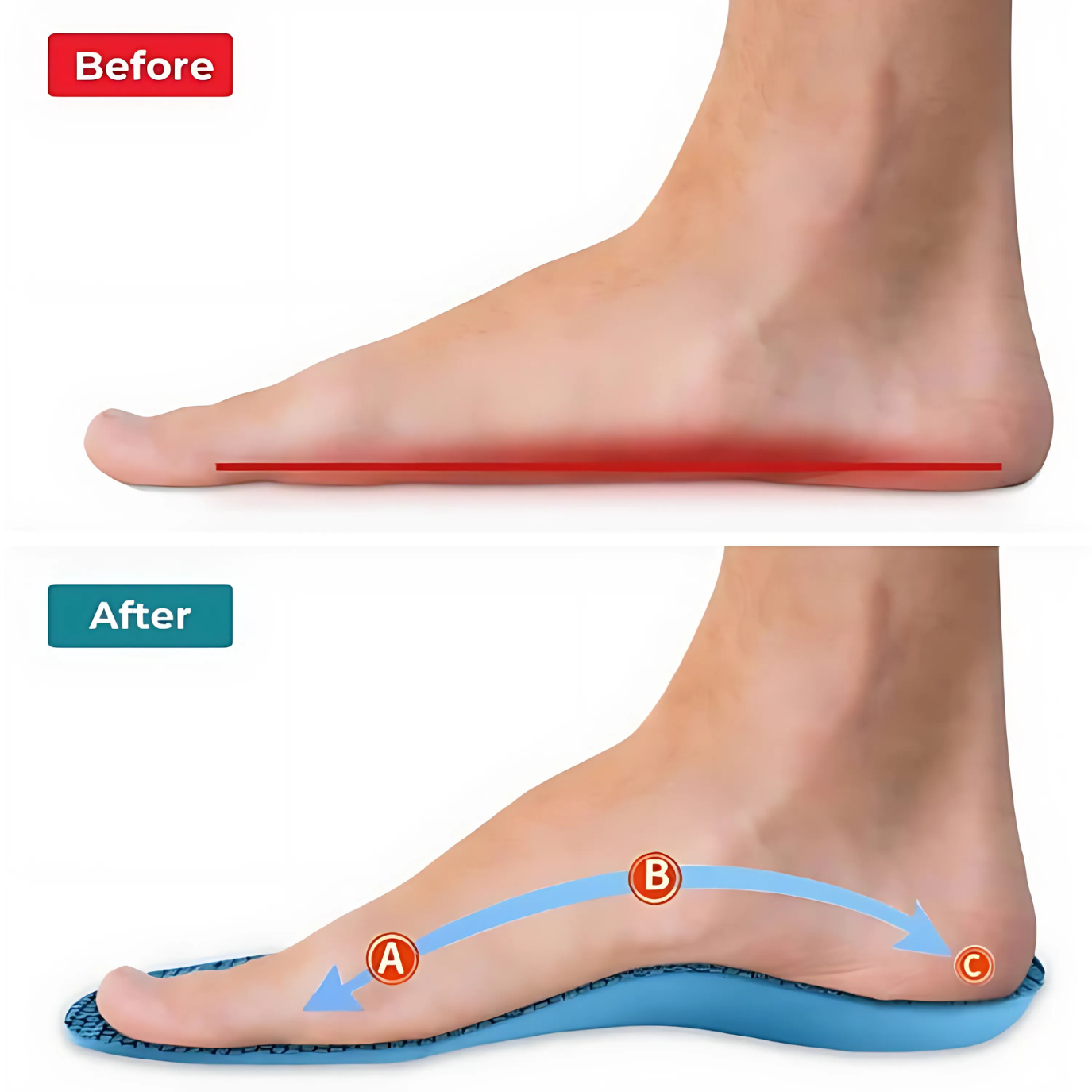 HEALIX | OrthoFlex PRO Insoles: Adjustable Size for Pain-Free Relief