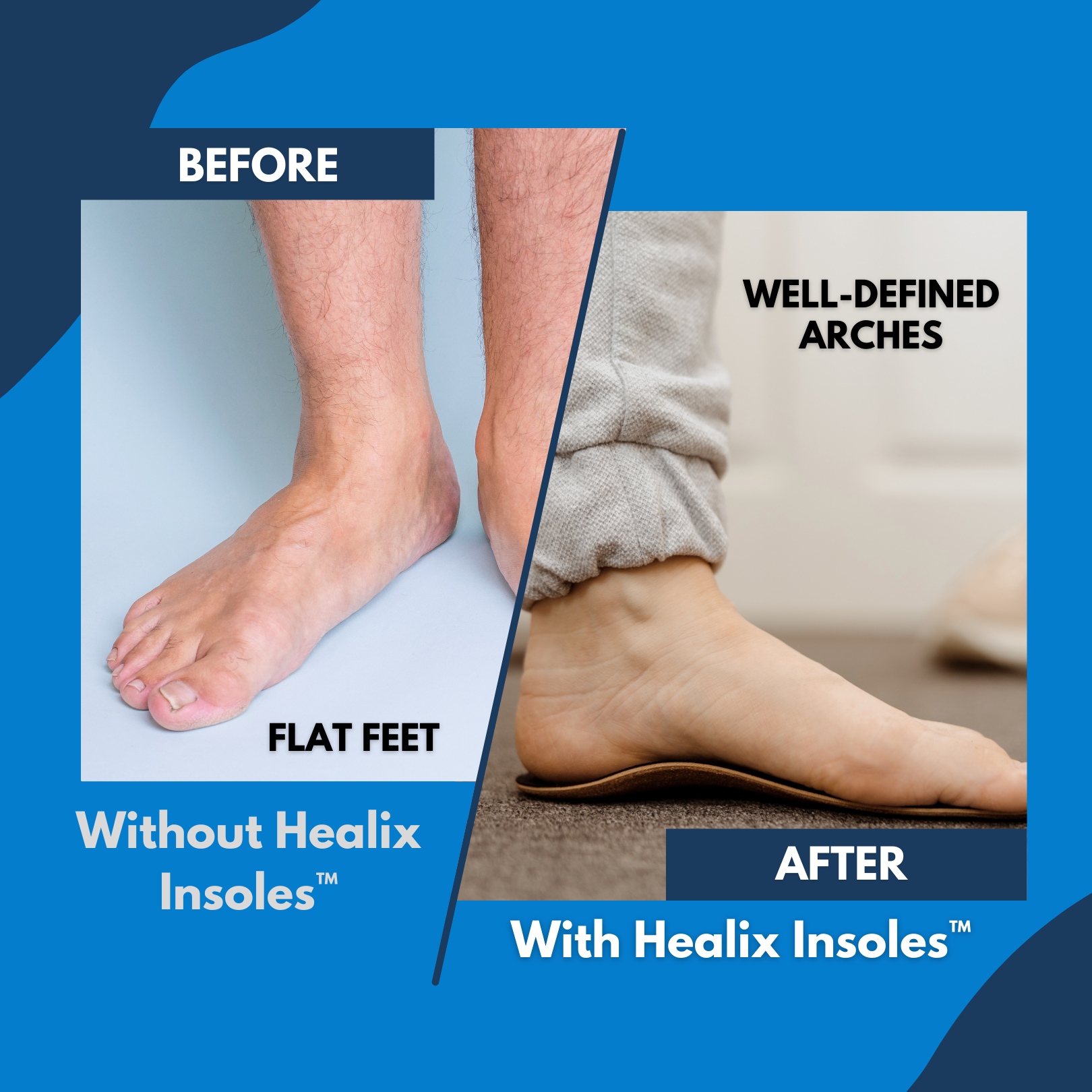 Healix Insoles: Relieve Pain & Protect Your Joints